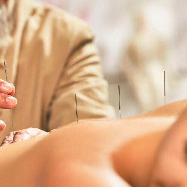 Can Acupuncture Help You Have Better Sex You Might Be Surprised